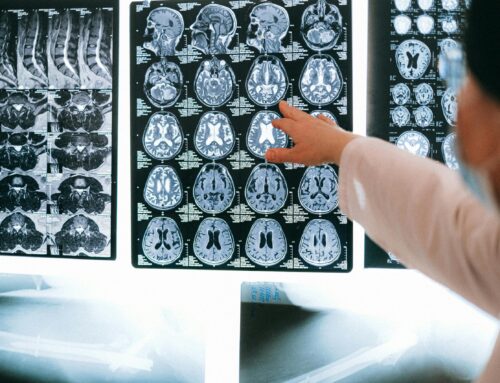 5 Myths About Traumatic Brain Injuries – And the Truth Behind Them